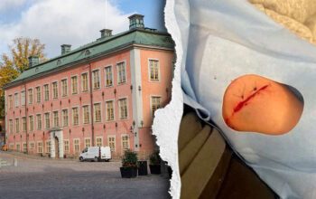 Till vänster en bild på Svea hovrätt på Riddarholmen i Stockholm. Till höger en bild på en underarm med ett ihopsytt sår på ca 4 cm.