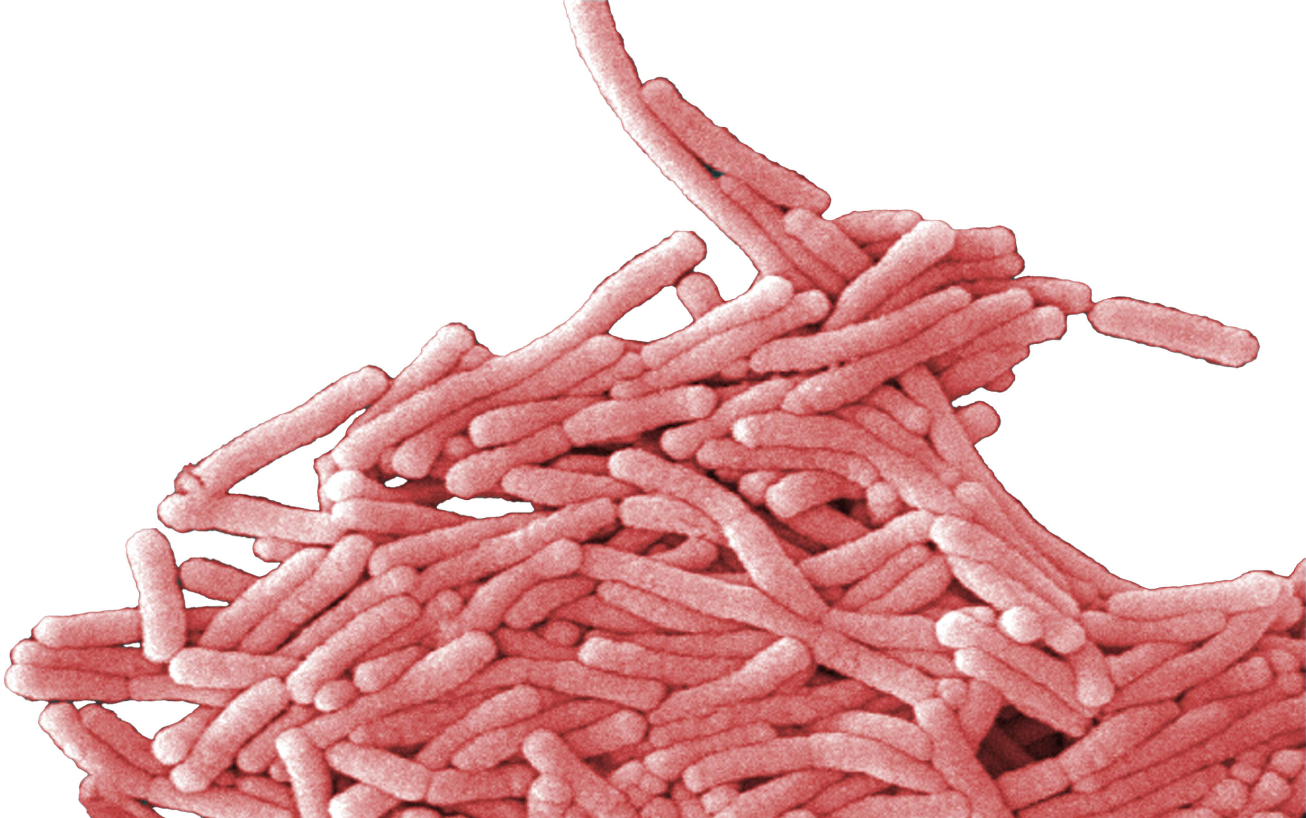 En mikroskopbild av bakterier, Legionella pneumophila.